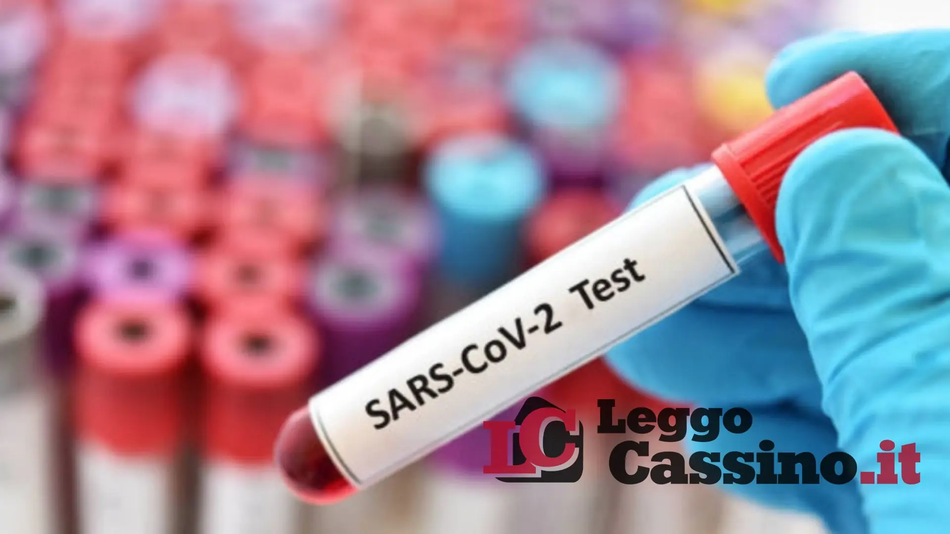 Covid, il "solito" calo del lunedì